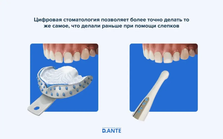 Цифровая стоматология: что это такое и кому это нужно