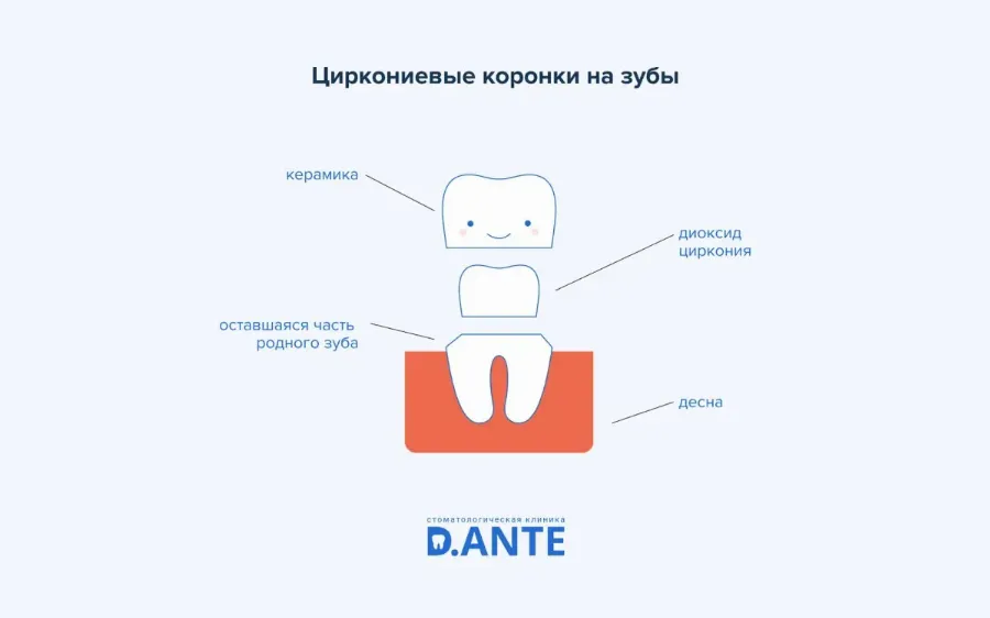 Коронки на зубы: показания, виды, стоимость