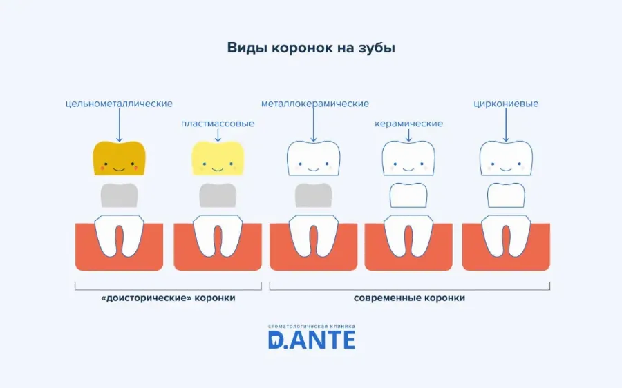 Коронки на зубы: показания, виды, стоимость
