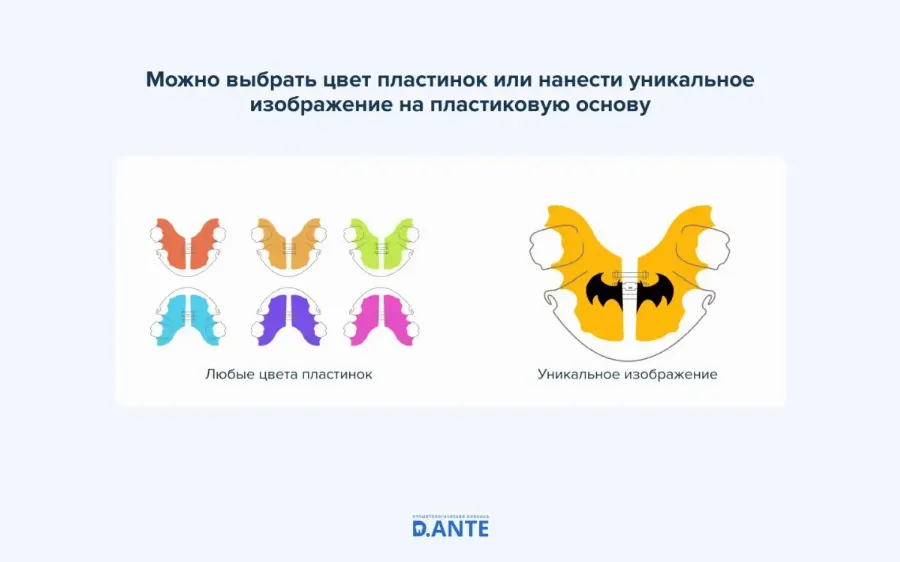 Накладки на зубы или вкладки в зубы?