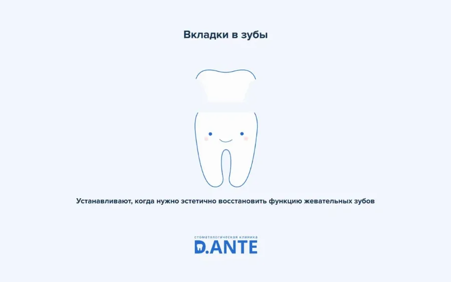 Накладки на зубы или вкладки в зубы?