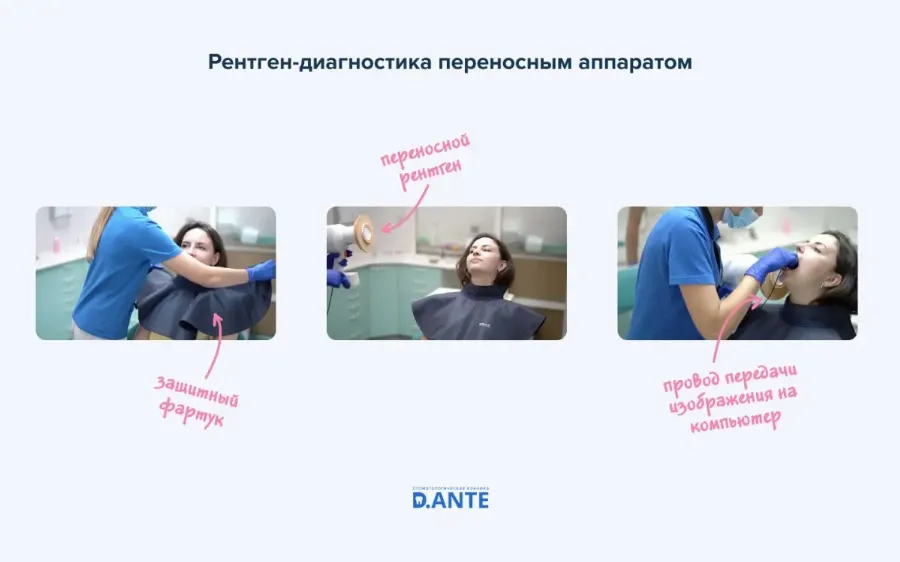 Рентген в стоматологии