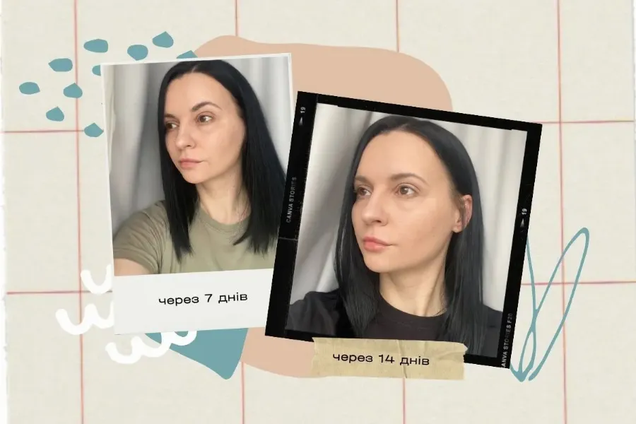 результати редермалізації