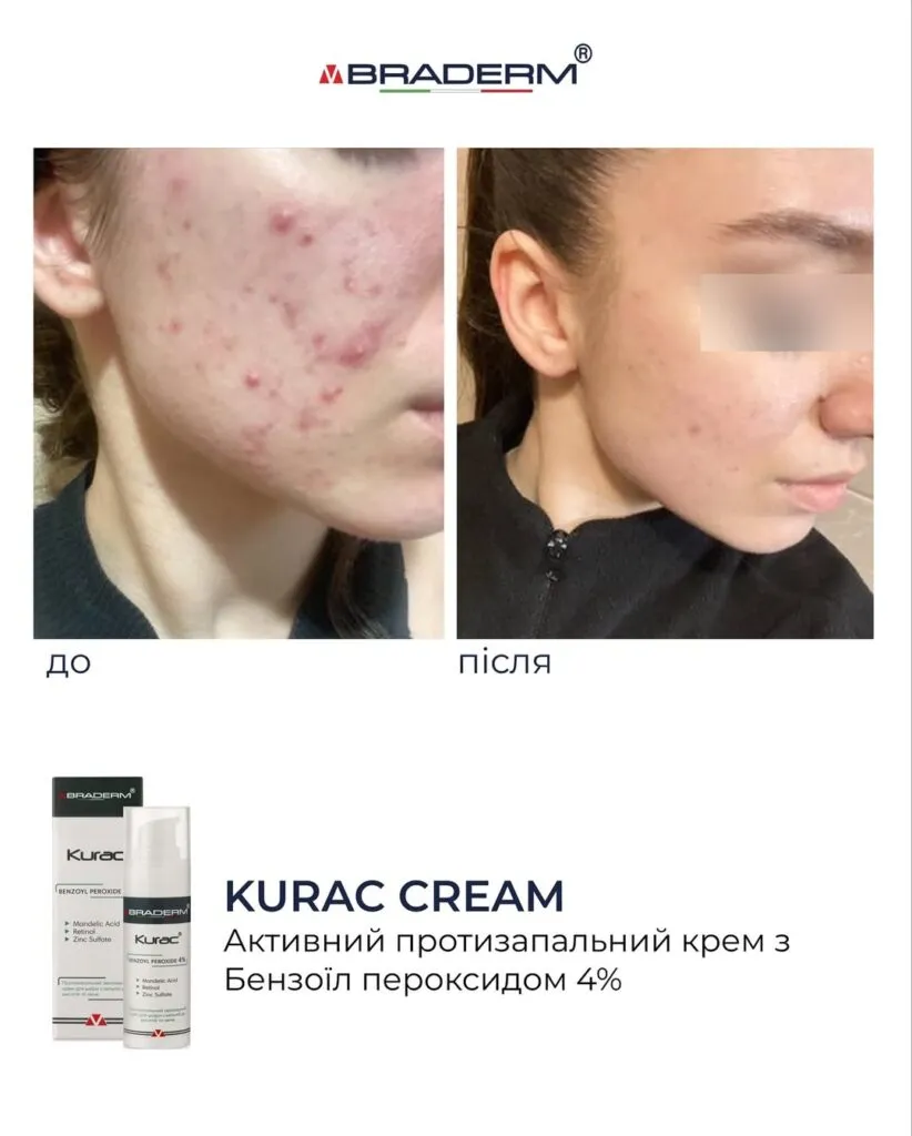 post_content