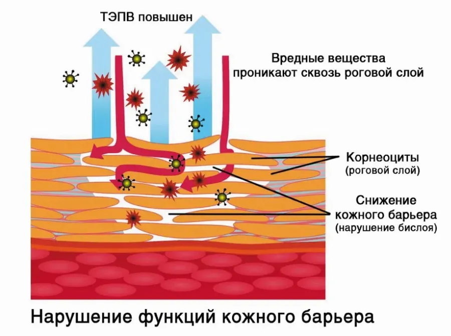 Корнеотерапия